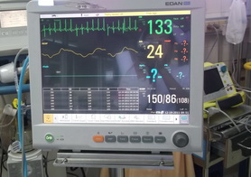 EKG_1_